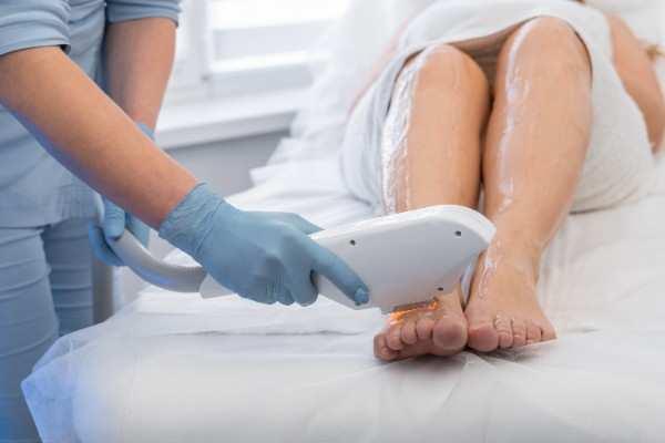 Laser Hair Removal in Lincoln