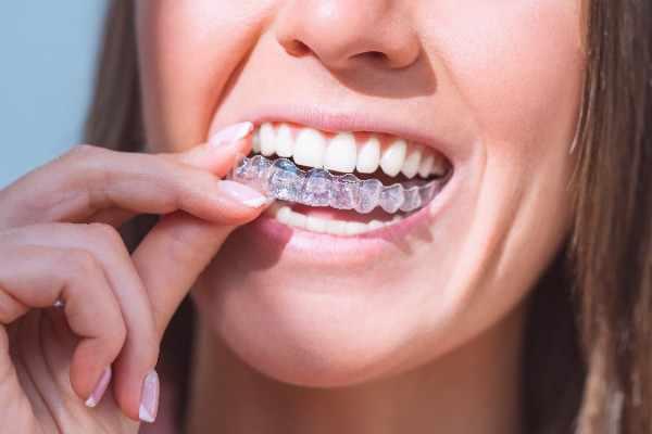  orthodontist Penzance
