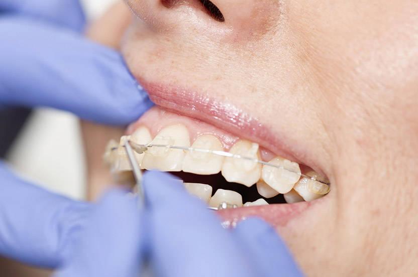 artfulorthodontics