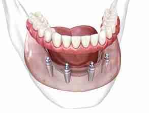 Image Source -Directory dental Manchester 